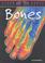 Cover of: Bones (Body Focus)