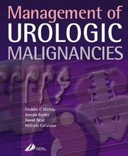 Cover of: Management Urologic Malignancies