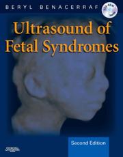 Cover of: Ultrasound of Fetal Syndromes by Beryl R. Benacerraf