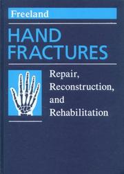 Hand fractures by Alan E. Freeland
