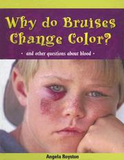 Cover of: Why Do Bruises Change Color? by Angela Royston