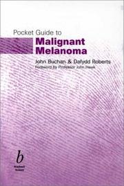 Cover of: Pocket Guide to Malignant Melanoma