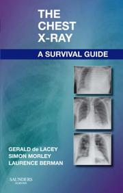 The chest X-ray by Gerald de Lacey, Simon Morley, Laurence Berman