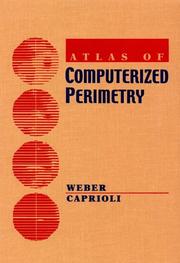 Cover of: Atlas of Computerized Perimetry | Jorg Weber
