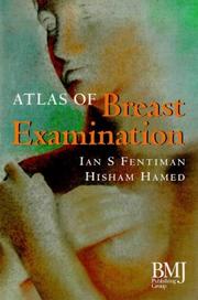 Cover of: Atlas of Breast Examination