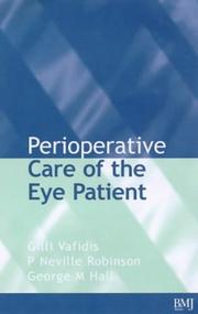 Cover of: Perioperative Care of the Eye Patient