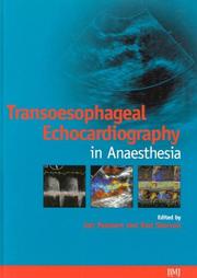 Cover of: Transoesophageal Echocardiography in Anaesthesia