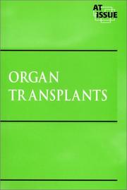 Cover of: Organ Transplants