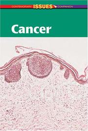 Cover of: Cancer (Contemporary Issues Companion)