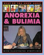 Cover of: What Do You Know About Anorexia? (What Do You Know About) by Pete Sanders, Steve Myers