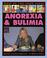 Cover of: What Do You Know About Anorexia? (What Do You Know About)