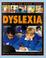 Cover of: What Do You Know About Dyslexia? (What Do You Know About)