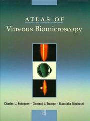 Cover of: Atlas of Vitreous Biomicroscopy