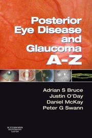 Posterior eye disease and glaucoma A-Z by Adrian S. Bruce, Justin O'Day, Daniel McKay, Peter G. Swann