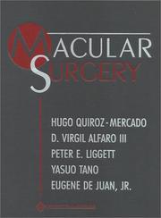 Cover of: Macular Surgery | Peter E. Liggett