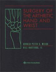 Cover of: Surgery of the Arthritic Hand and Wrist | 