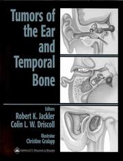 Tumors of the ear and temporal bone by Robert K. Jackler, Colin L. W. Driscoll