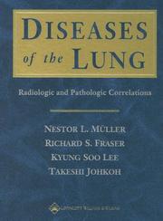 Cover of: Diseases of the Lung: Radiologic and Pathologic Correlations