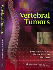 Cover of: Vertebral Tumors