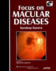 Cover of: Focus on Macular Diseases: Co-Published by Jaypee Brothers and Lippincott Williams & Wilkins