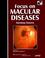 Cover of: Focus on Macular Diseases