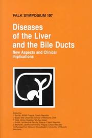 Cover of: Diseases of the Liver and the Bile Ducts: New Aspects and Clinical Implications (Falk Symposium)