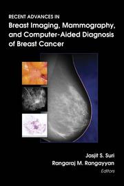 Cover of: Recent Advances in Breast Imaging, Mammography, and Computer-Aided Diagnosis of Breast Cancer (SPIE Press Monograph Vol. PM155) by 