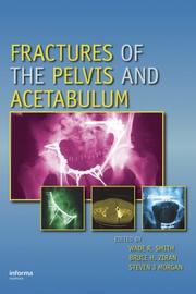 Cover of: Fractures of the Pelvis and Acetabulum