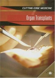 Cover of: Organ Transplants (Cutting Edge Medicine)