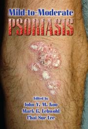 Cover of: Mild-to-Moderate Psoriasis