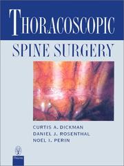 Cover of: Thoracoscopic Spine Surgery by 
