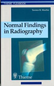 Cover of: Normal Findings in Radiography