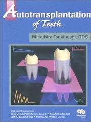 Cover of: Autotransplantation of Teeth by Mitsuhiro Tsukiboshi, Jens O. Andreasen, Lyasuhiro Asai, Leif K. Bakland, Thomas G., Jr. Wilson