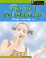 Cover of: Why Do I Get Sunburn?: And Other Questions About Skin (Body Matters)