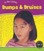 Cover of: Bumps & Bruises (Heinemann First Library) by Angela Royston