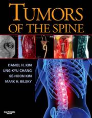 Cover of: Tumors of the Spine with DVD