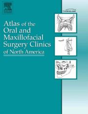 Oral Cancer, An Issue of Oral and Maxillofacial Surgery Clinics (The Clinics: Dermatology) by Sanjay P. Reddi