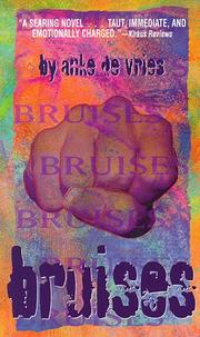Cover of: Bruises (Laurel-Leaf Books)