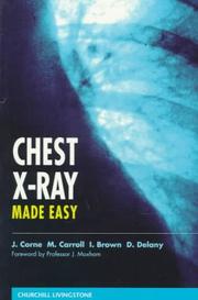Chest X-ray made easy by Jonathan Corne
