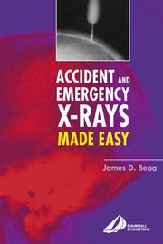 Cover of: Accident and Emergency X-Rays Made Easy by James D. Begg