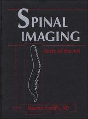 Cover of: Spinal Imaging by Mauricio Castillo