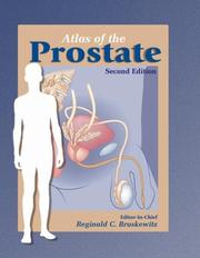 Atlas of the Prostate by Reginald Bruskewitz