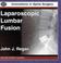 Cover of: Laparoscopic Lumbar Fusion