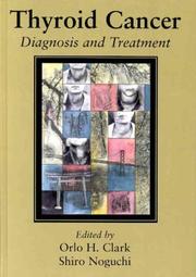 Cover of: Thyroid Cancer: Diagnosis and Treatment