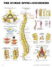 Cover of: Human Spine Disorders Chart