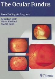 Cover of: The Ocular Fundus: From Findings to Diagnosis