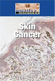 Cover of: Skin Cancer (Diseases and Disorders) by Bonnie Juettner