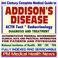 Cover of: 21st Century Complete Medical Guide to Addison¿s Disease, Hypocortisolism, Adrenal Gland Insufficiency, ACTH Test, Authoritative CDC, NIH, and FDA Documents, Clinical References, and Practical Information for Patients and Physicians (CD-ROM)