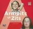 Cover of: Armpits to Zits