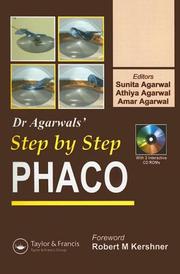 Cover of: Step by Step Phaco